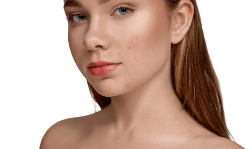 c2 sld bf - FOLOLO BEAUTY c2 sld bf